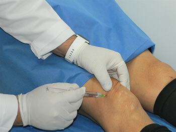 Infiltración ecoguiada para manejo del dolor en rodilla.